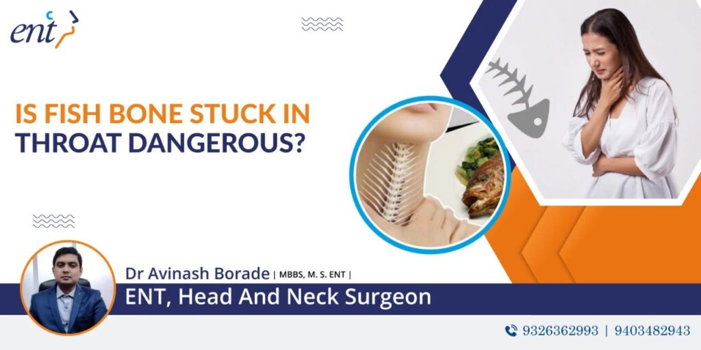 Is Fish Bone Stuck in Throat Dangerous?