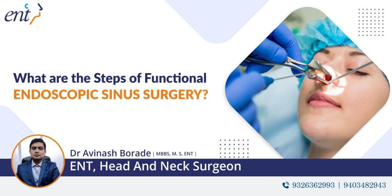 What are the Steps of Functional Endoscopic Sinus Surgery?