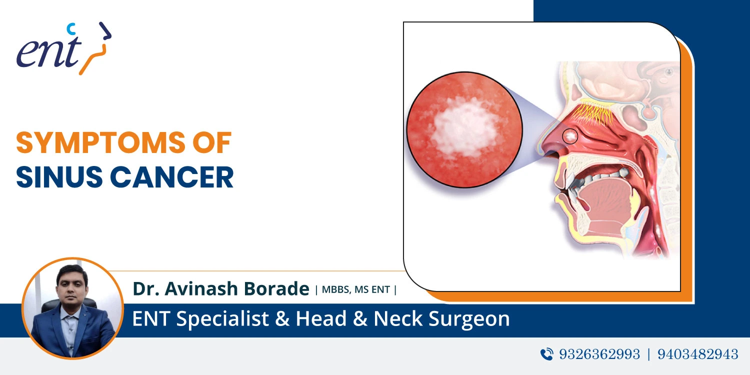 symptoms of sinus cancer