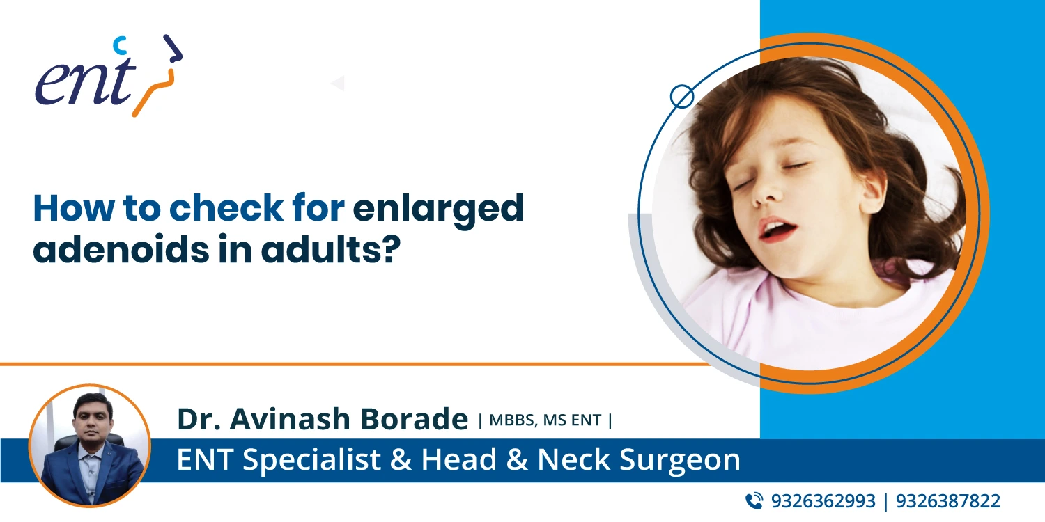 How to Check for Enlarged Adenoids in Adults