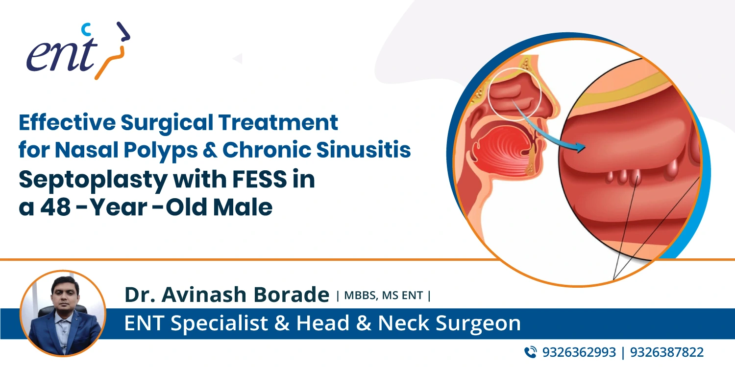 Effective Surgical Treatment for Nasal Polyps and Chronic Sinusitis: Septoplasty with FESS in a 48-Year-Old Male