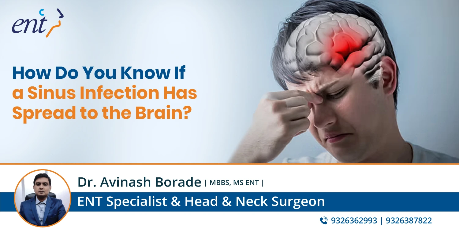 How Do You Know If a Sinus Infection Has Spread to the Brain?