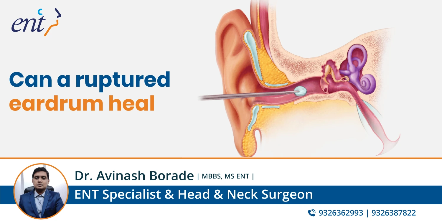 Can a Ruptured Eardrum Heal