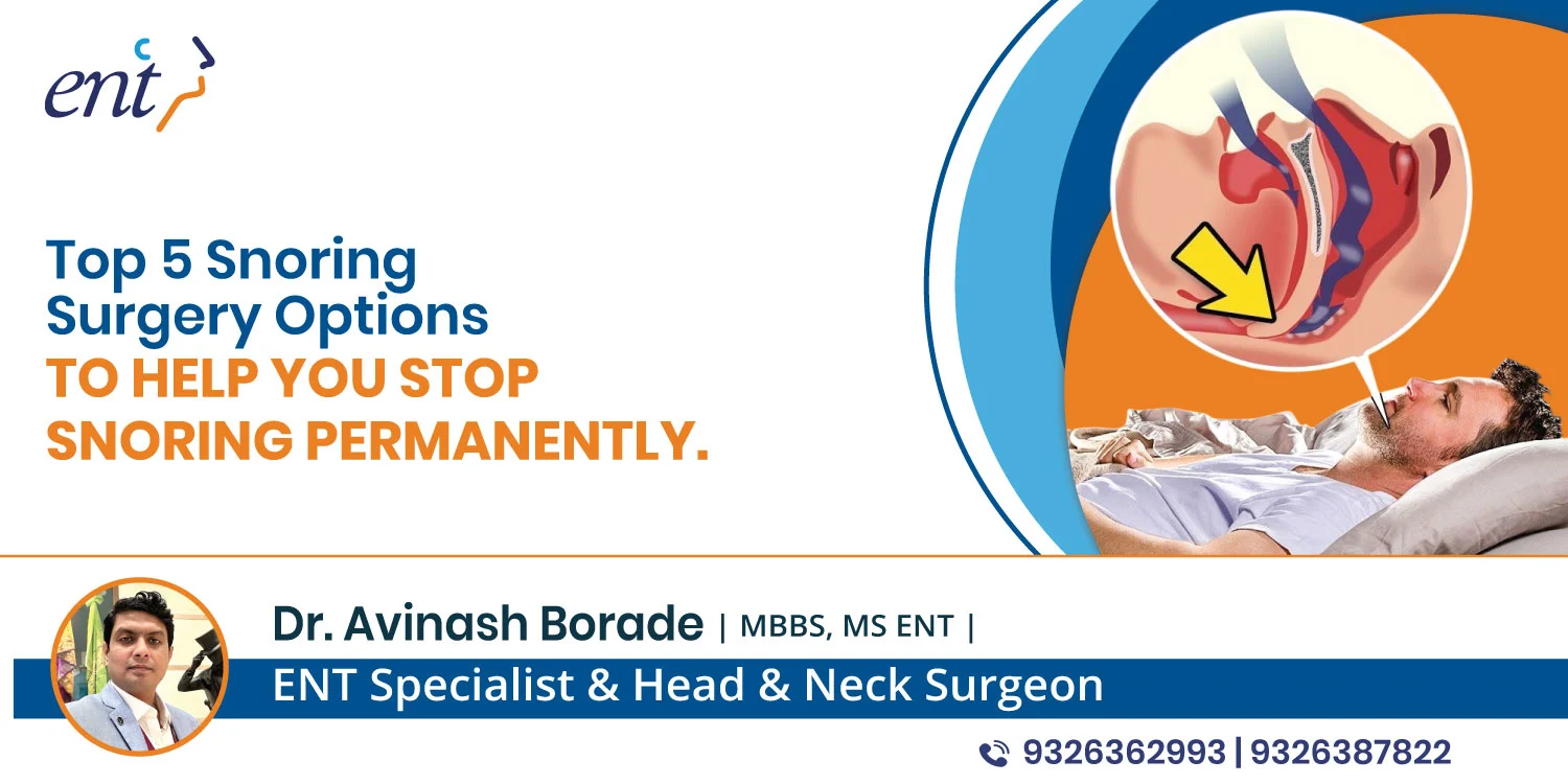 Top 5 Snoring Surgery Options to Help You Stop Snoring Permanently
