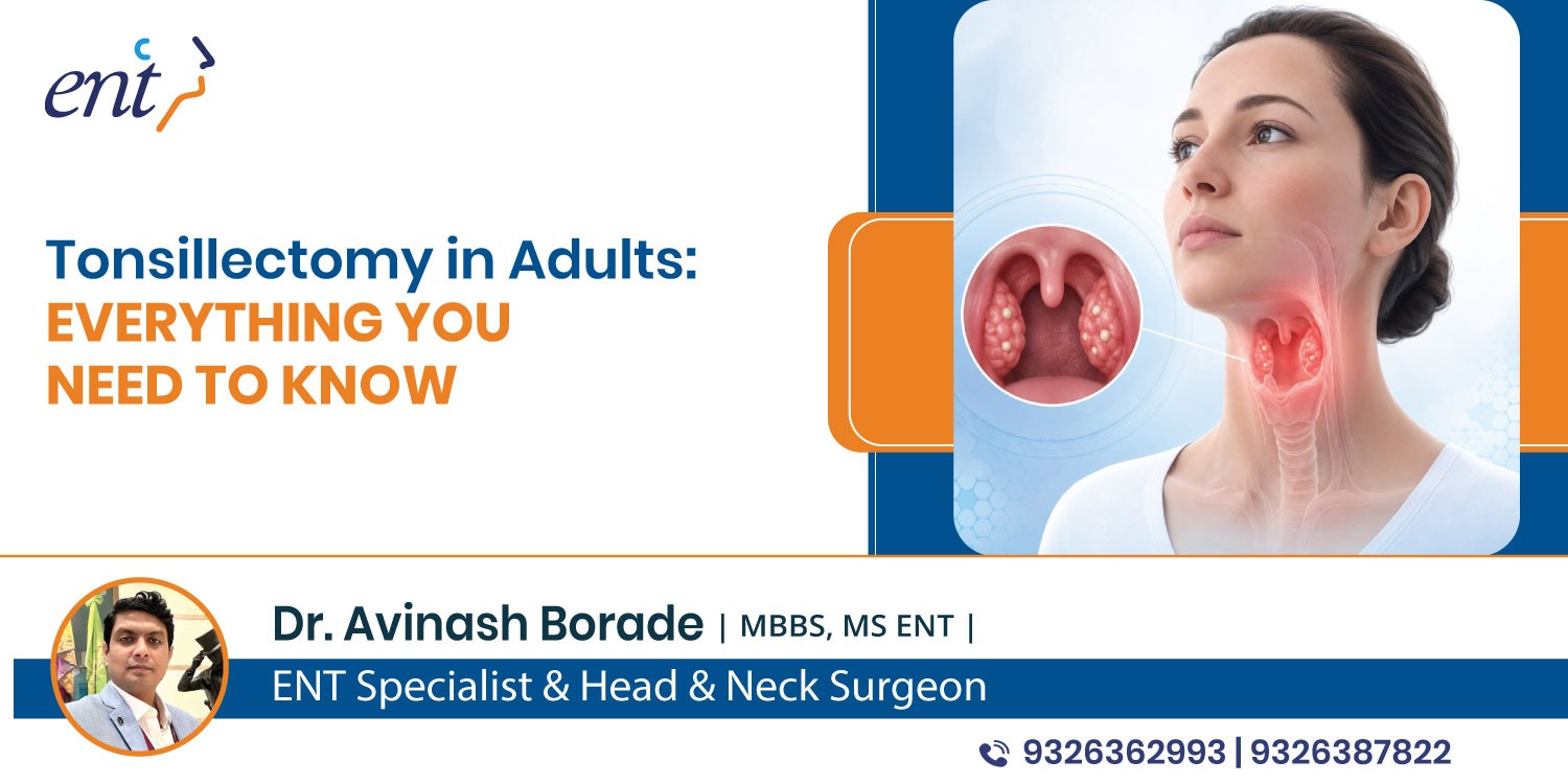 Tonsillectomy in Adults: Everything You Need to Know