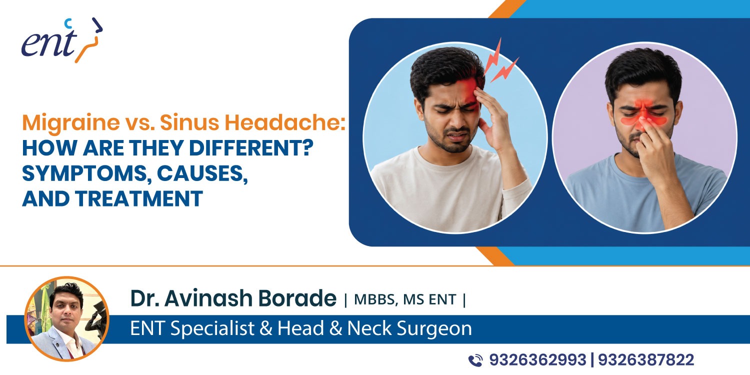 Migraine vs. Sinus Headache: How Are They Different? Symptoms, Causes, and Treatment