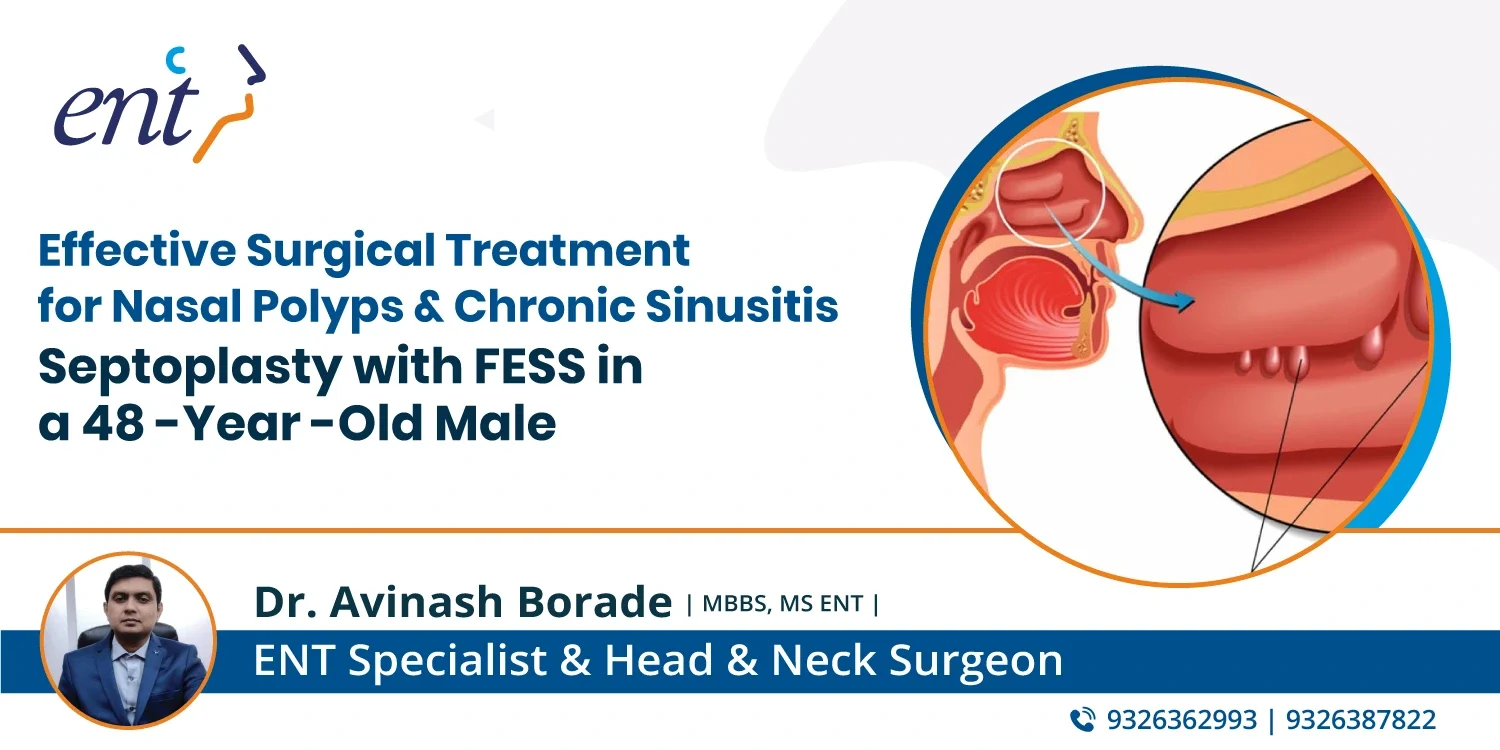 Effective Surgical Treatment for Nasal Polyps and Chronic Sinusitis: Septoplasty with FESS in a 48-Year-Old Male