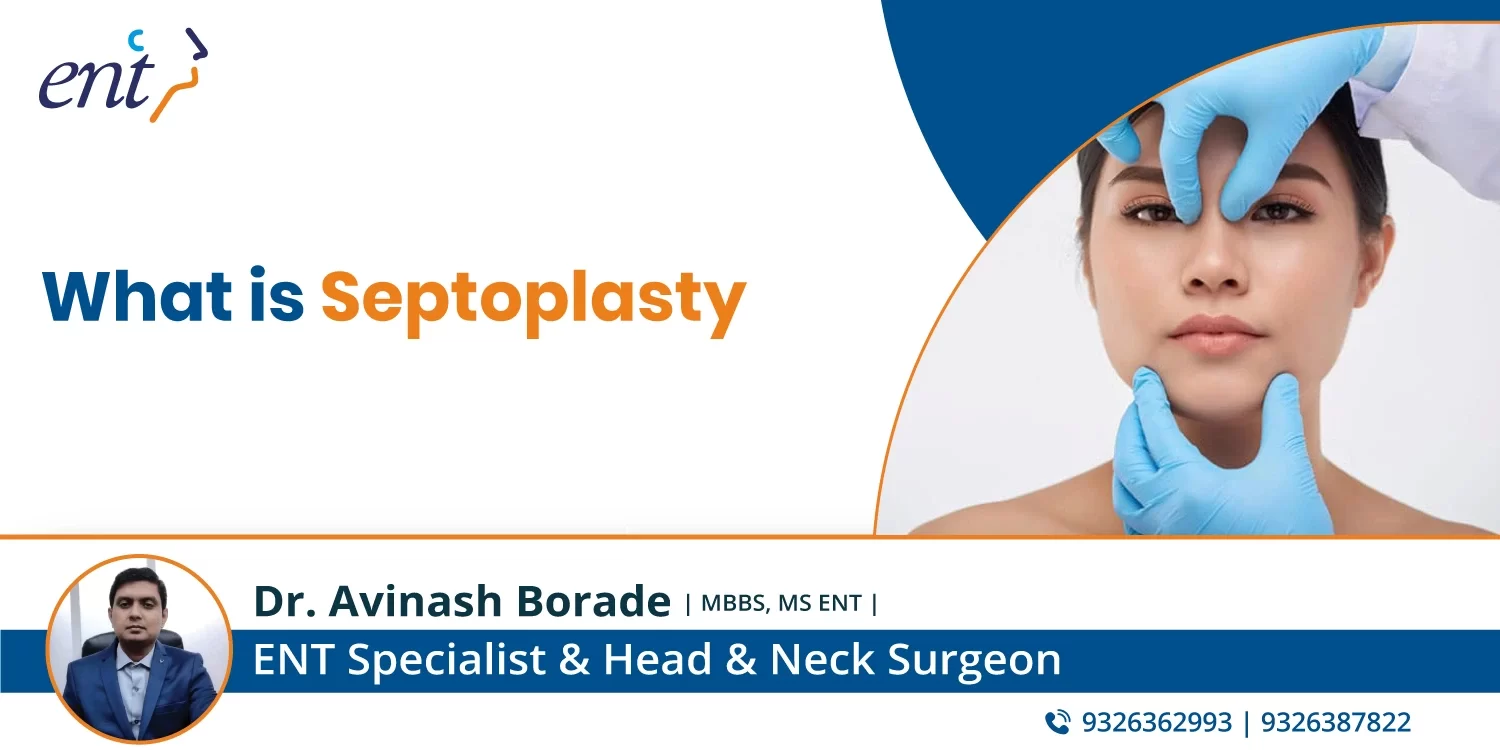 What is Septoplasty?