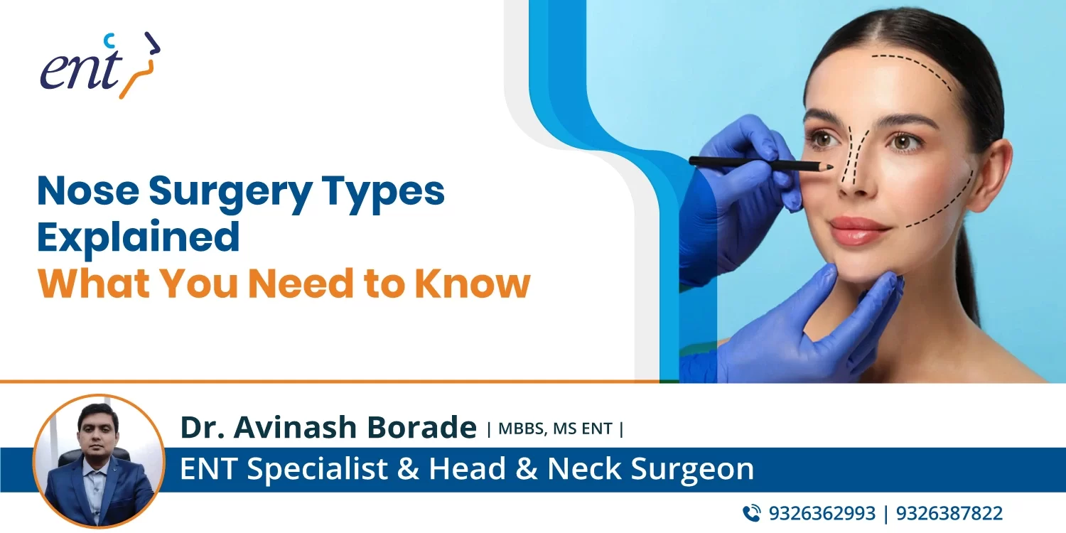 Nose Surgery Types Explained: What You Need to Know