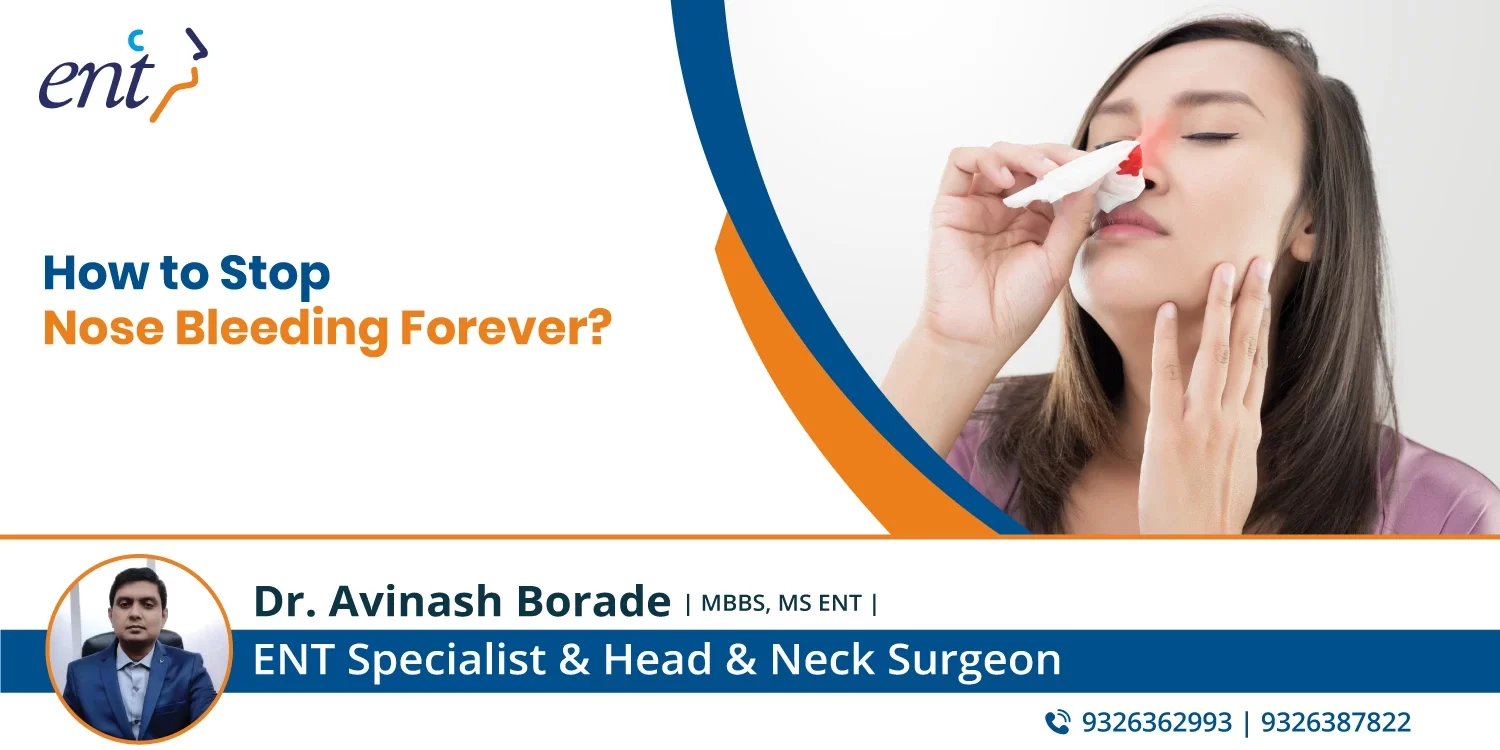 How to Stop Nose Bleeding Forever