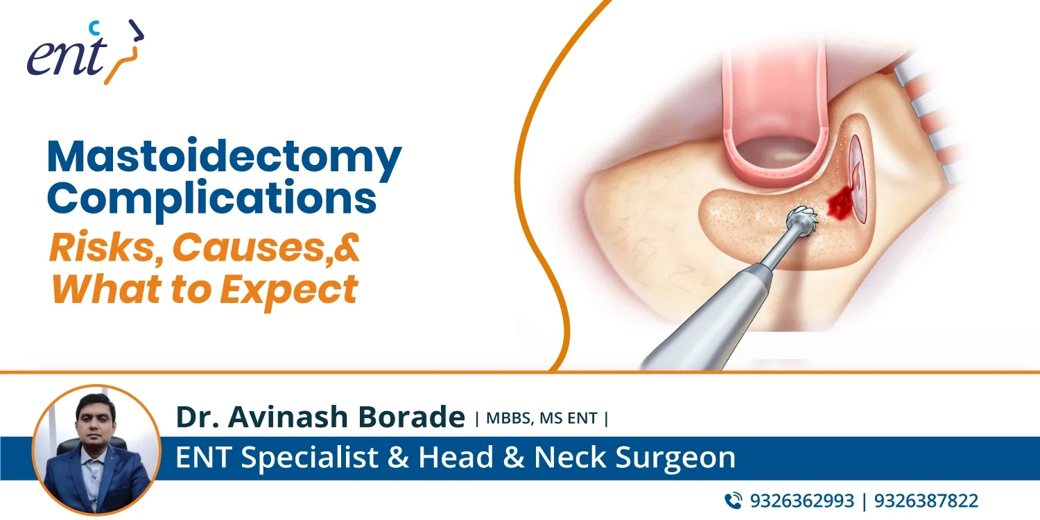 mastoidectomy surgery
