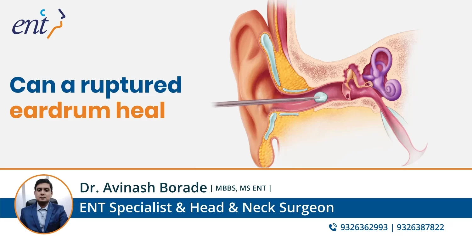 Can a Ruptured Eardrum Heal