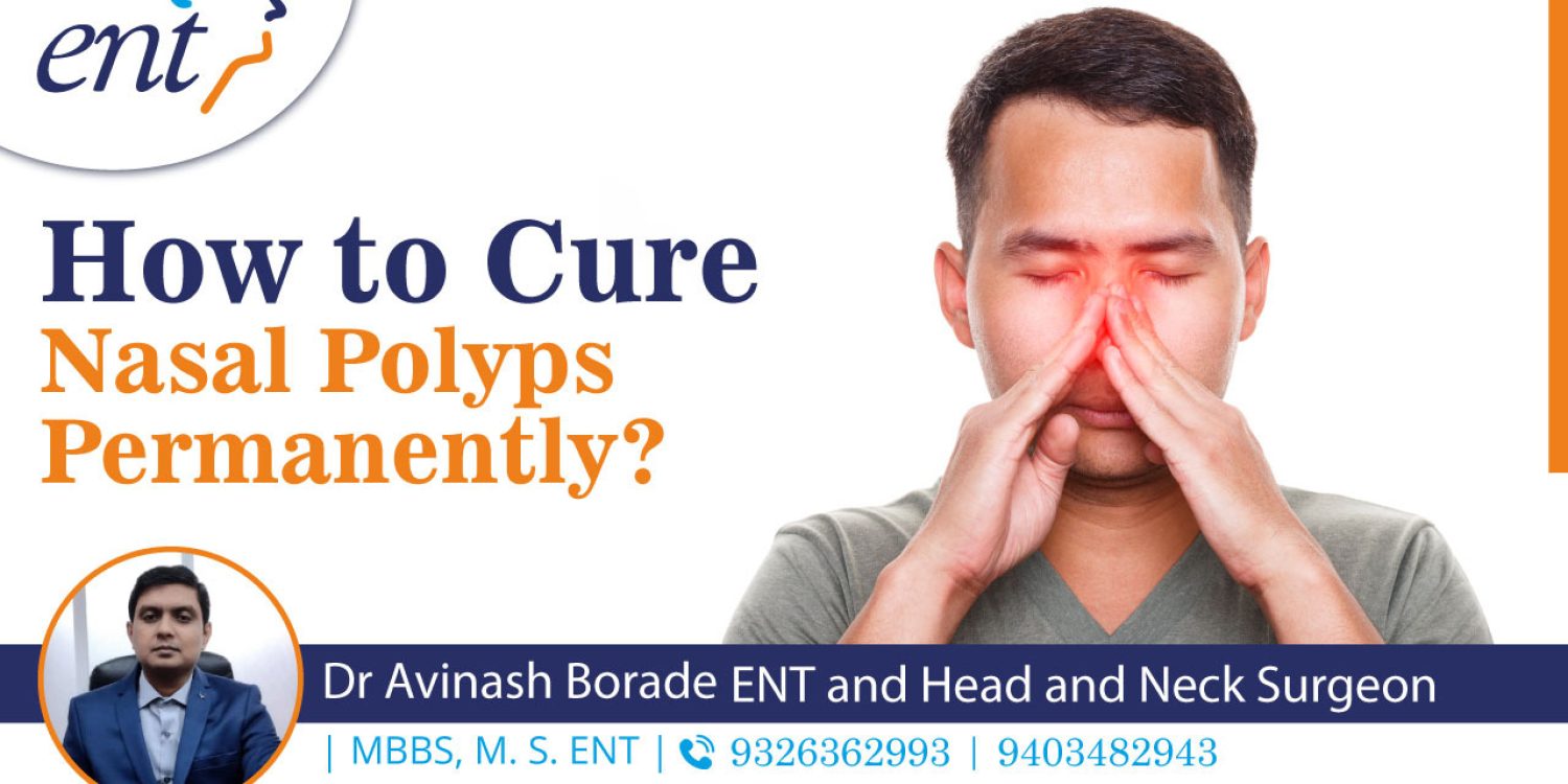 How to Cure Nasal Polyps Permanently?