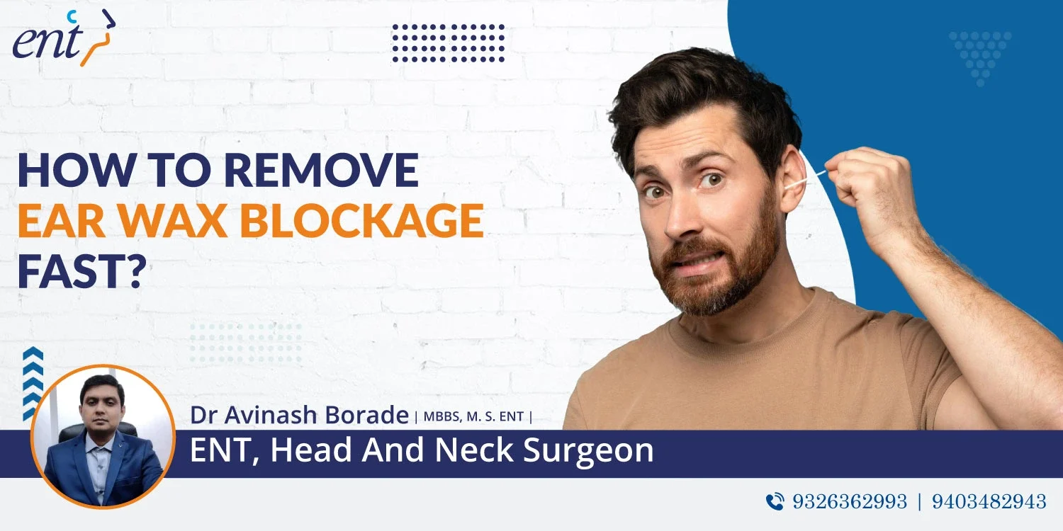 How to remove ear wax blockage fast