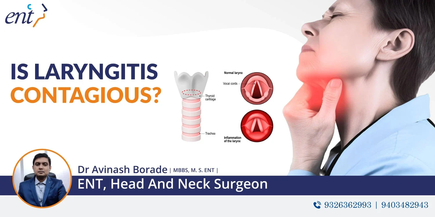 Is laryngitis contagious