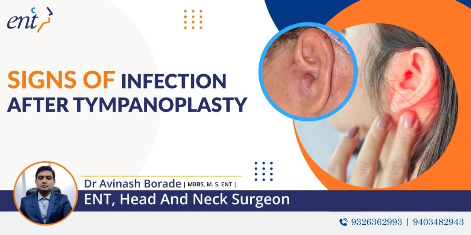 Signs of Infection After Tympanoplasty