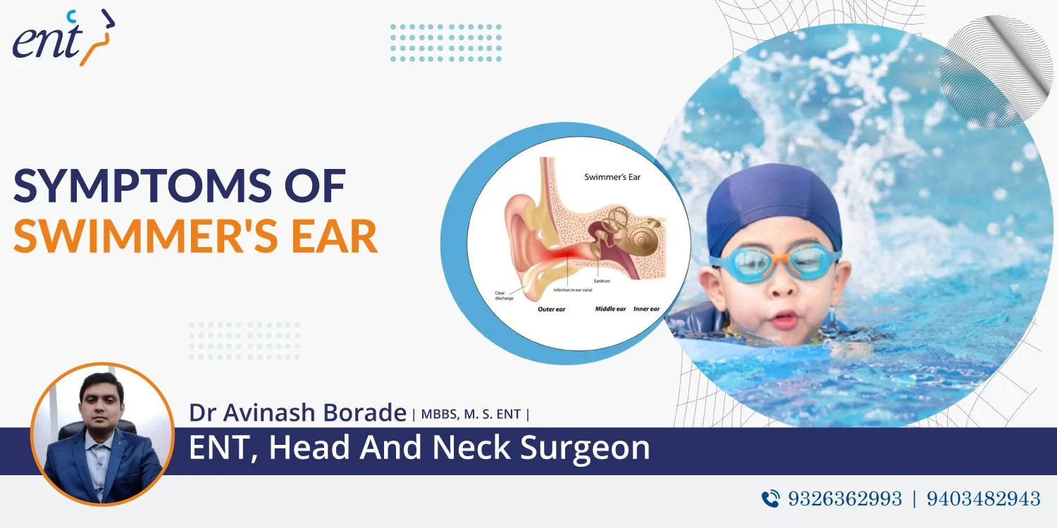 Symptoms of Swimmer's Ear