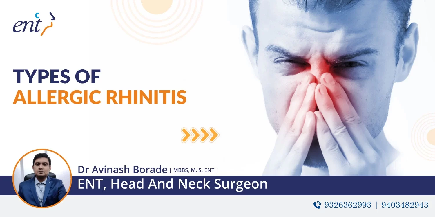 Types of Allergic Rhinitis