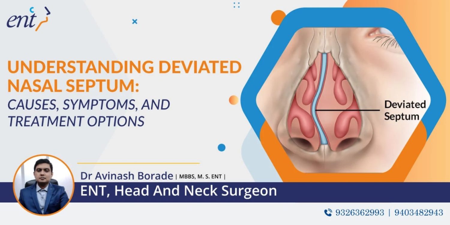 Understanding Deviated Nasal Septum Causes Symptoms and Treatment Options