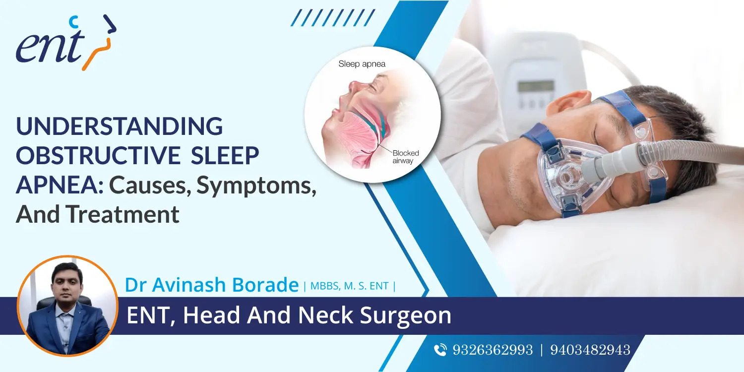 Understanding Obstructive Sleep Apnea_ Causes, Symptoms, and Treatment