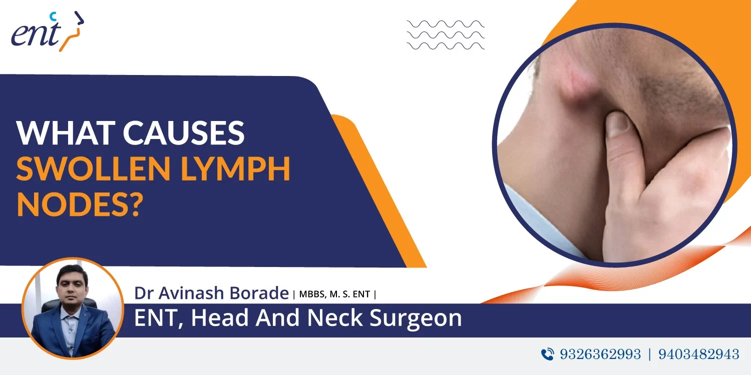 What Causes Swollen Lymph Nodes