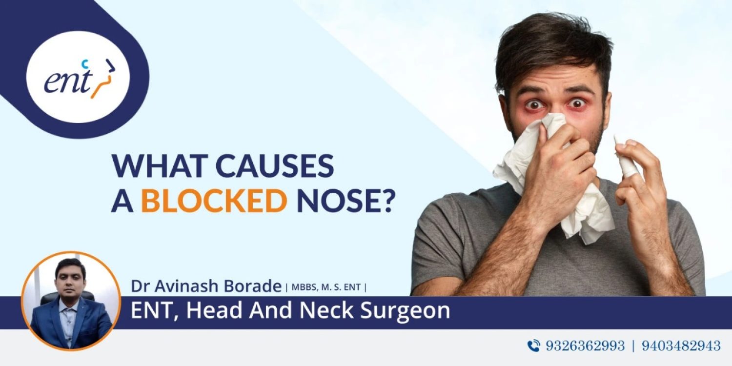 What Causes a Blocked Nose