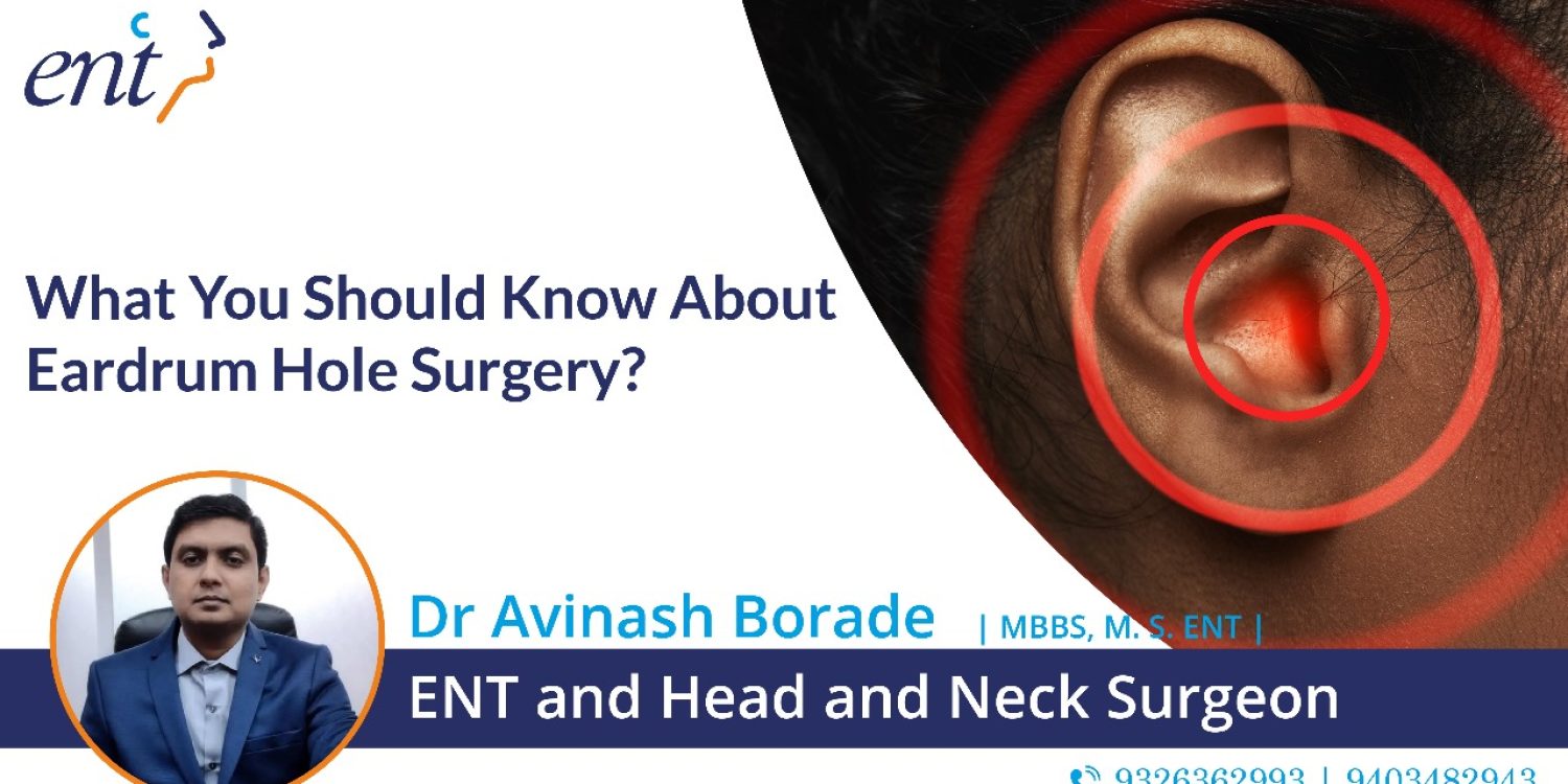 What You Should Know About Eardrum Hole Surgery