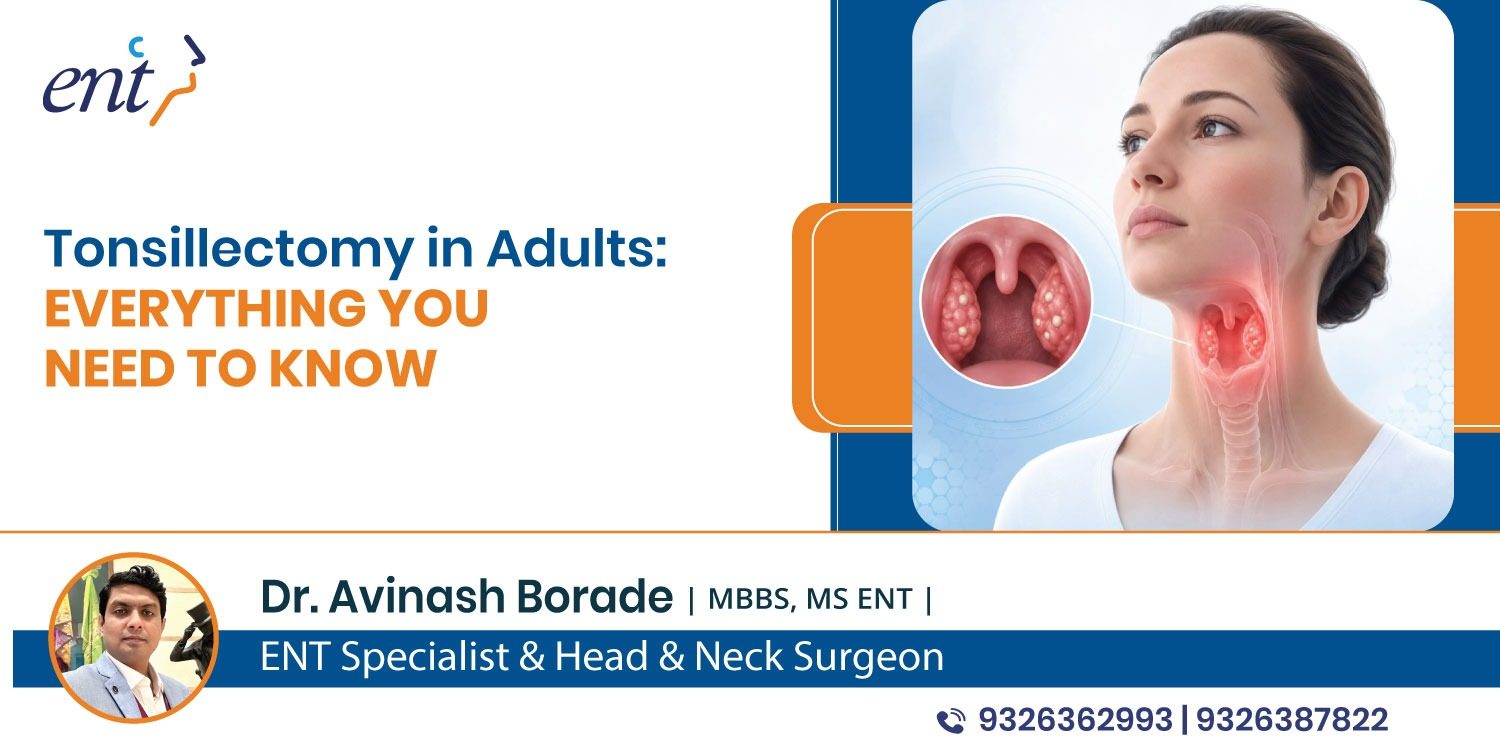Tonsillectomy in Adults: Everything You Need to Know